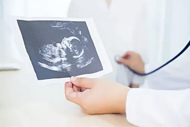 胎儿肾积水孕妇注意事项是什么