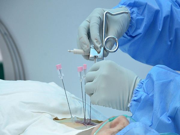 北医三院做绒毛穿刺的时间是多久