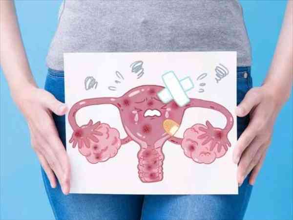 多囊卵巢最快受孕方法是什么？