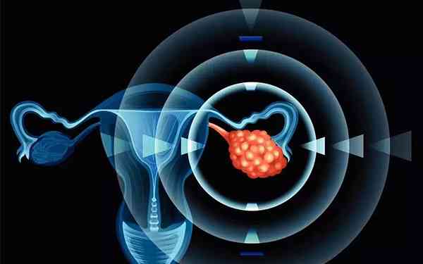 卵巢早衰可以吃肌醇吗？