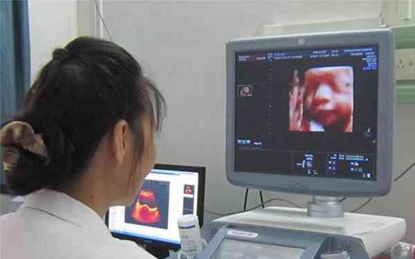 彩超时医生问一胎二胎暗示什么？