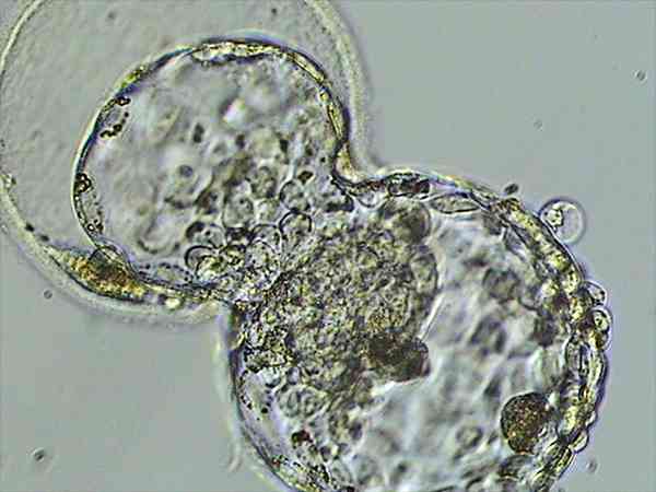 有生下囊胚4bc的宝宝吗？