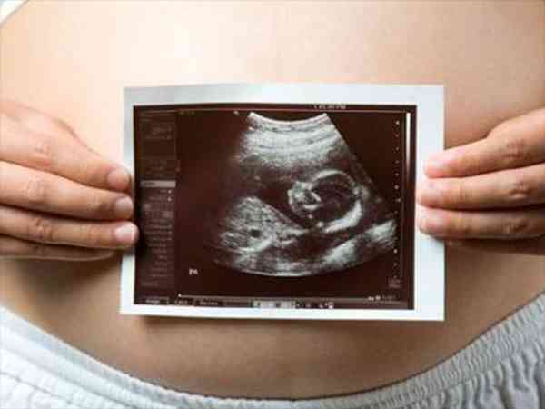 怀孕12周彩超真实图片图片