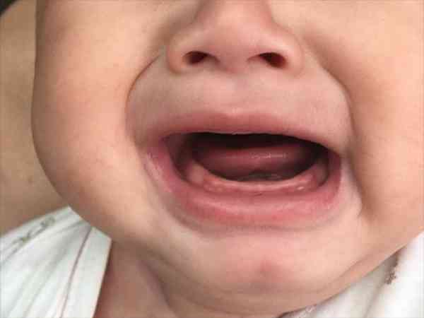 老一辈说宝宝太早长牙大凶是真的吗？
