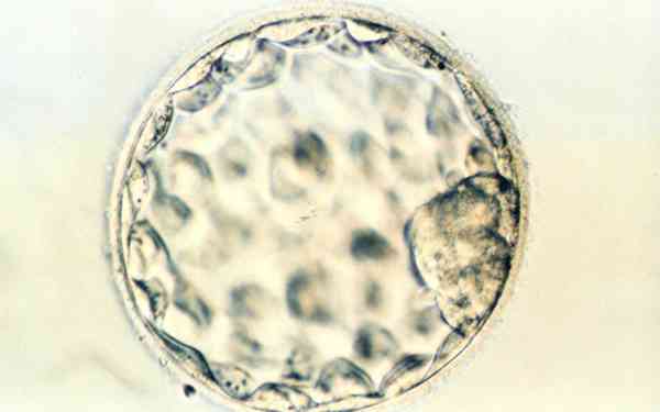 试管受精卵胚胎分级是什么？