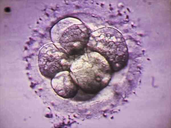 为什么囊胚4bc几乎都是女孩？