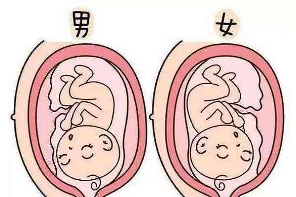 孕13周可以通过nt图片上胎儿姿势看男女吗?