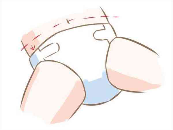 纸尿裤遮住肚脐的危害有哪些？