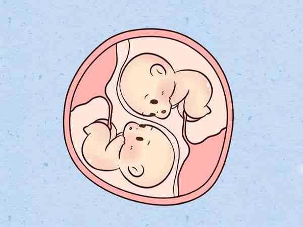 同卵双胎减胎最佳时间是多久？