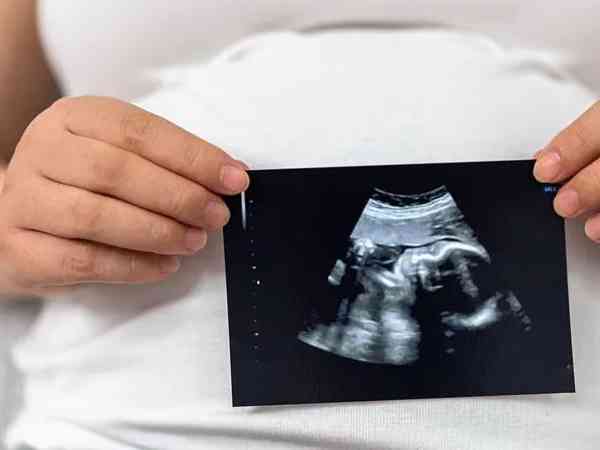 怀孕几个月看双顶径是最准的？