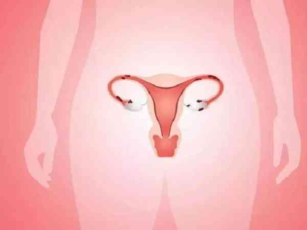 排卵期子宫内膜会出现三线征吗？