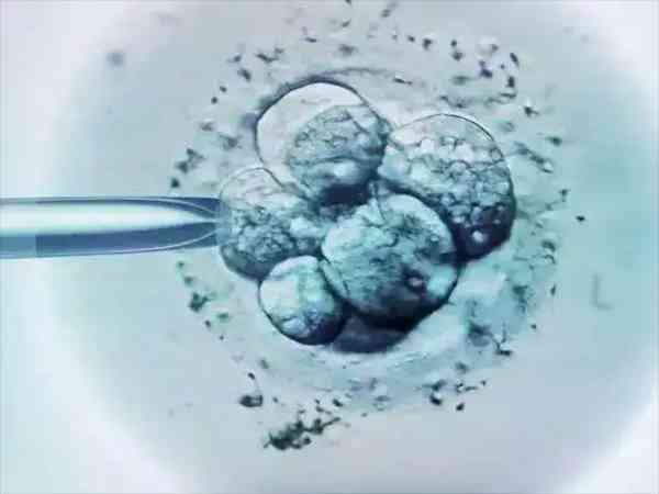 胚胎碎片率多少正常？