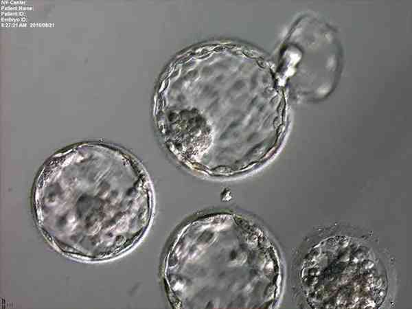 为什么养囊胚那么容易死？