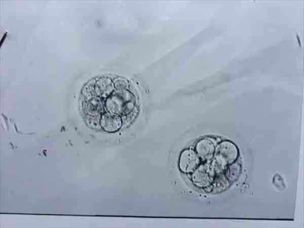 移植卵裂期的胚胎好还是囊胚好？