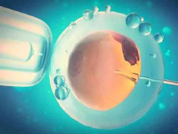 医生建议鲜胚移植的原因是什么？