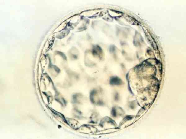 有生下囊胚3bc的宝宝吗？
