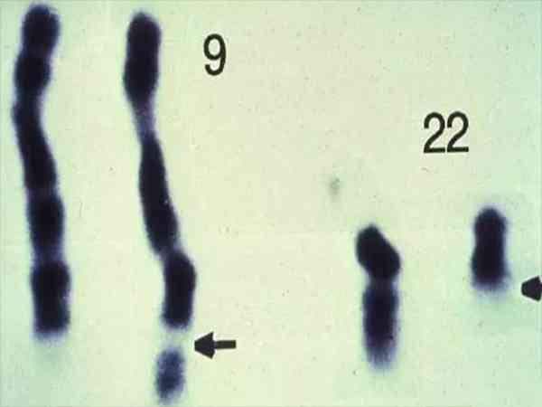 22号染色体三体胚胎怎么预防？