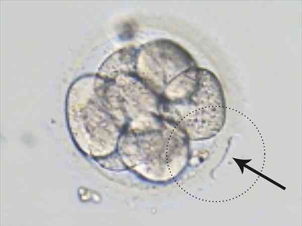 胚胎透明带厚做孵化会成功吗？