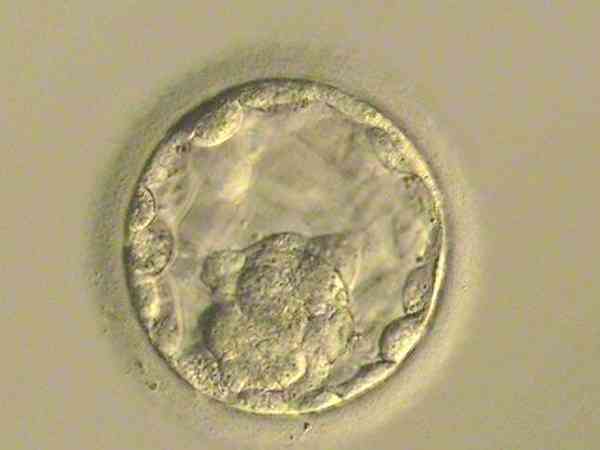 胚胎5ab是什么级别？
