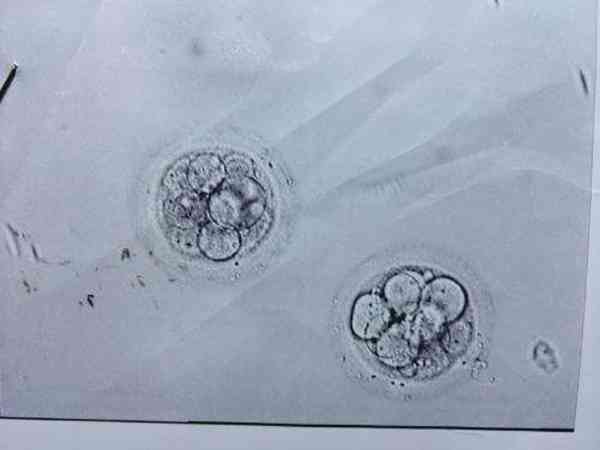 7天4bc囊胚能移植吗？