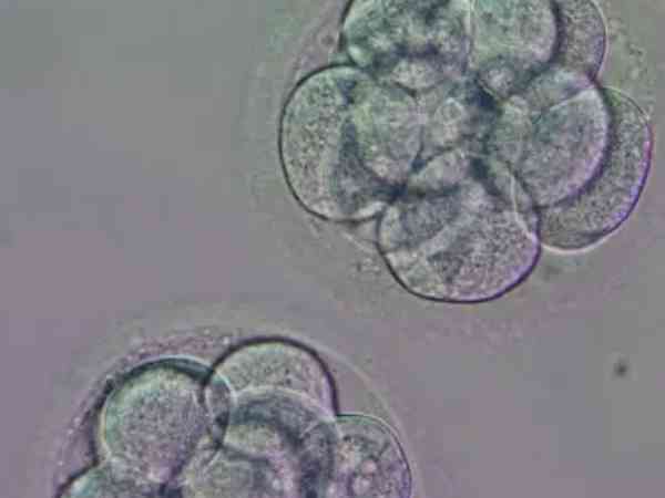 3bb和4bb囊胚哪个好？