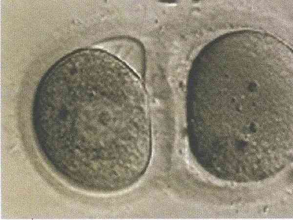 卵子透明带异常做试管还能怀孕吗？