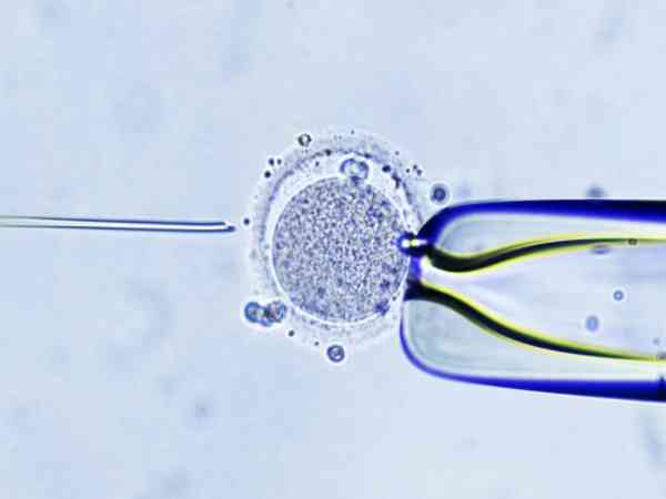 试管会优先放优质胚胎吗？