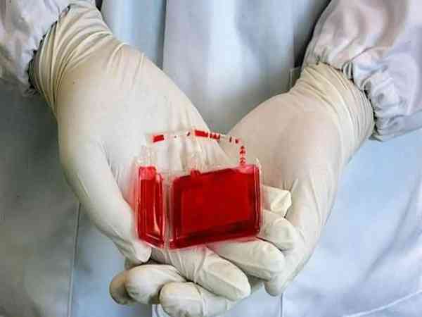 为什么国家不推行脐带血的普及？