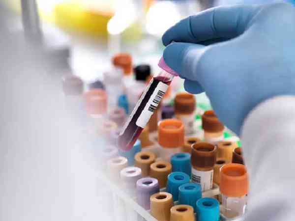 香港抽血血做胎儿性别检测多久出结果？