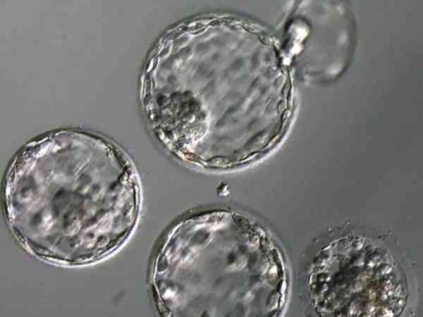 实验室人员能看出来囊胚的性别吗？