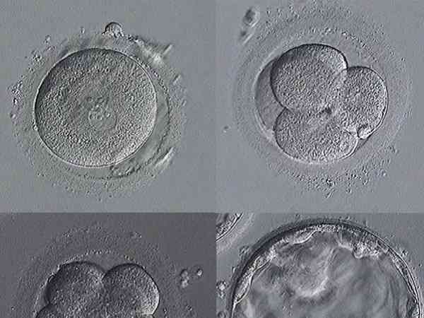 三级八细胞的鲜胚质量怎么样？