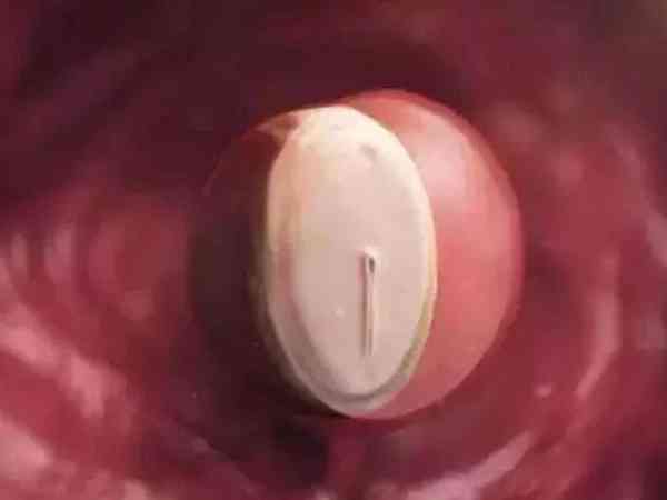 4ab属于一级优质的囊胚吗？