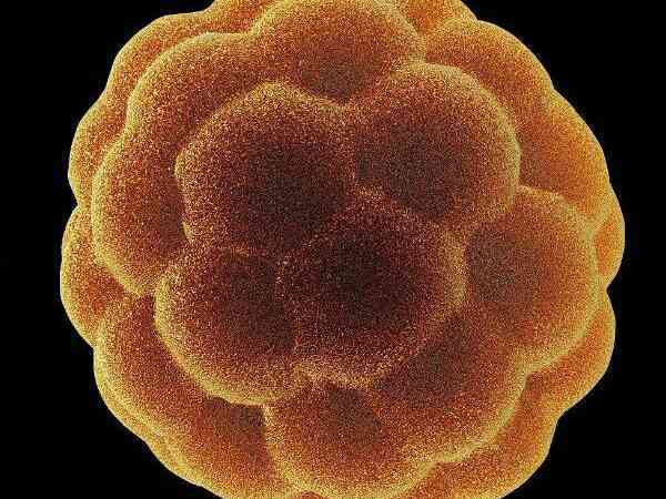 胚胎嵌合体产生的原因有哪些？