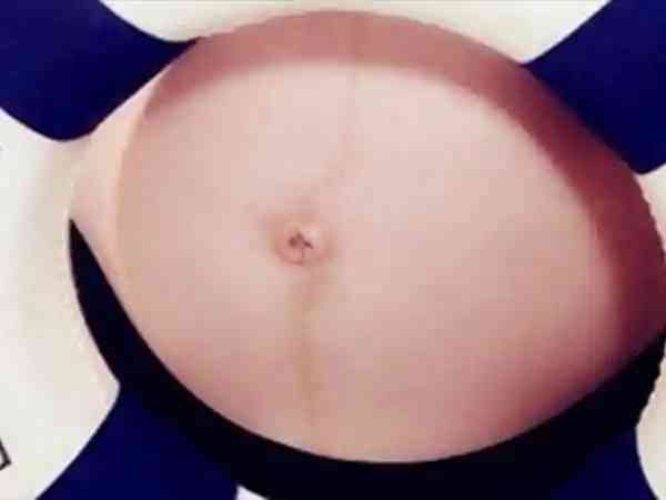肚脐外翻是怀的男孩还是女孩？