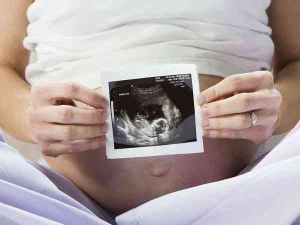 美国怀孕产检鉴定胎儿性别合法吗？