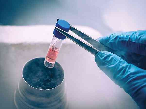 做供精试管申请精子库精子有什么条件吗？