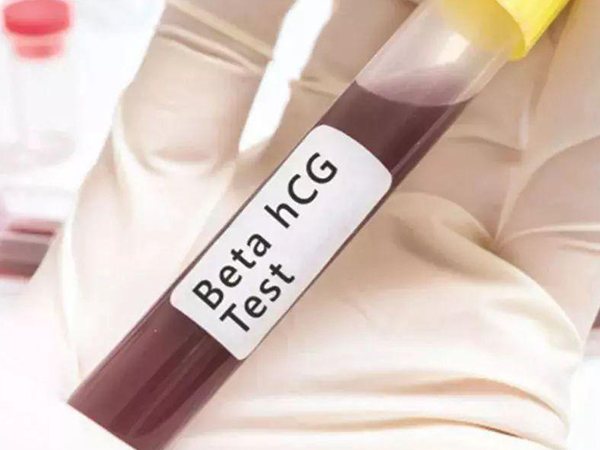 抽血验hcg是最早的验孕方法
