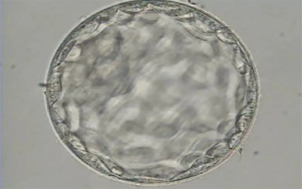 4aa囊胚正常移植下的成功率是很高的
