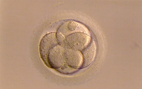 4ab属于优质囊胚