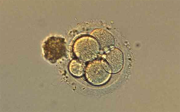 4CB囊胚是处于扩张期的囊胚