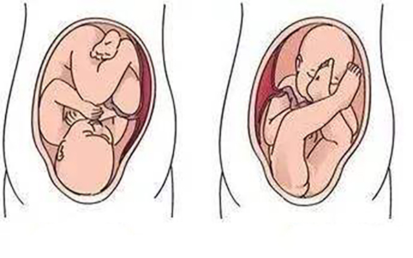 自己摸又硬又圆的是胎儿的头部