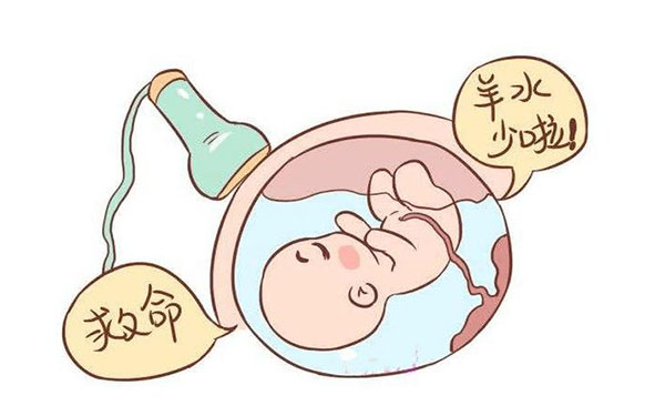 孕妇肚子里的羊水偏少可能是孩子憋尿造成的