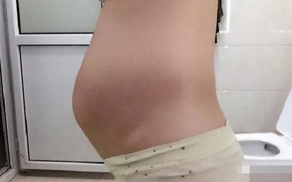 怀男宝的肚型整体像一个倒梯形