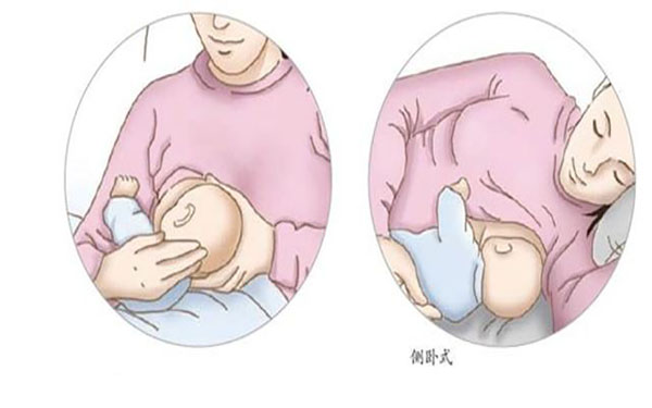 哺乳期大小胸可以通过通乳改善