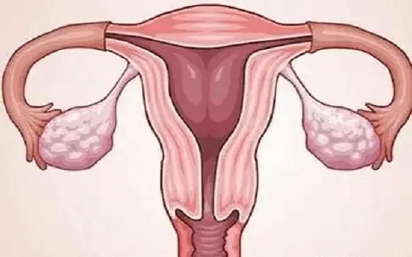 诊刮刺激内膜用于子宫内膜比较薄的女性
