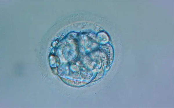 4AC囊胚是二级的胚胎