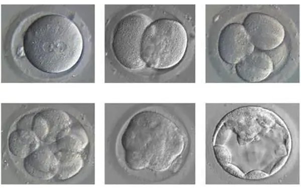 6AC囊胚是无法看出生男生女的