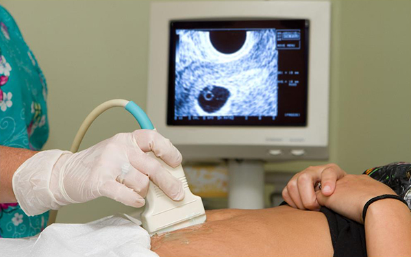孕八周有胎芽没胎心可能会保胎成功