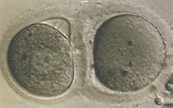 GV期卵母细胞可以在体外继续培养