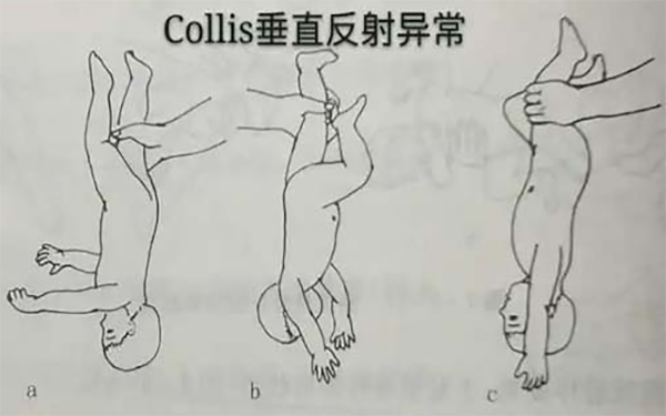 Collis垂直反射异常